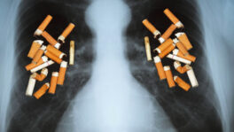 Lungs polluted with cigarettes